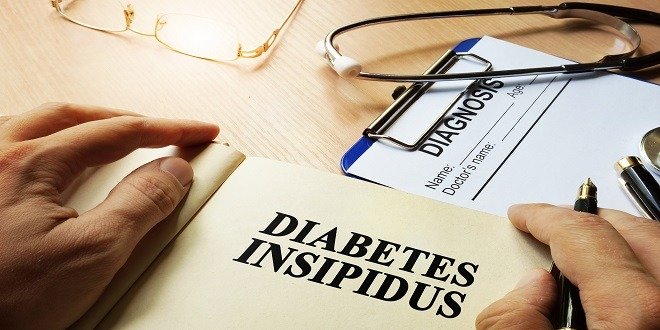diabetes insipidus